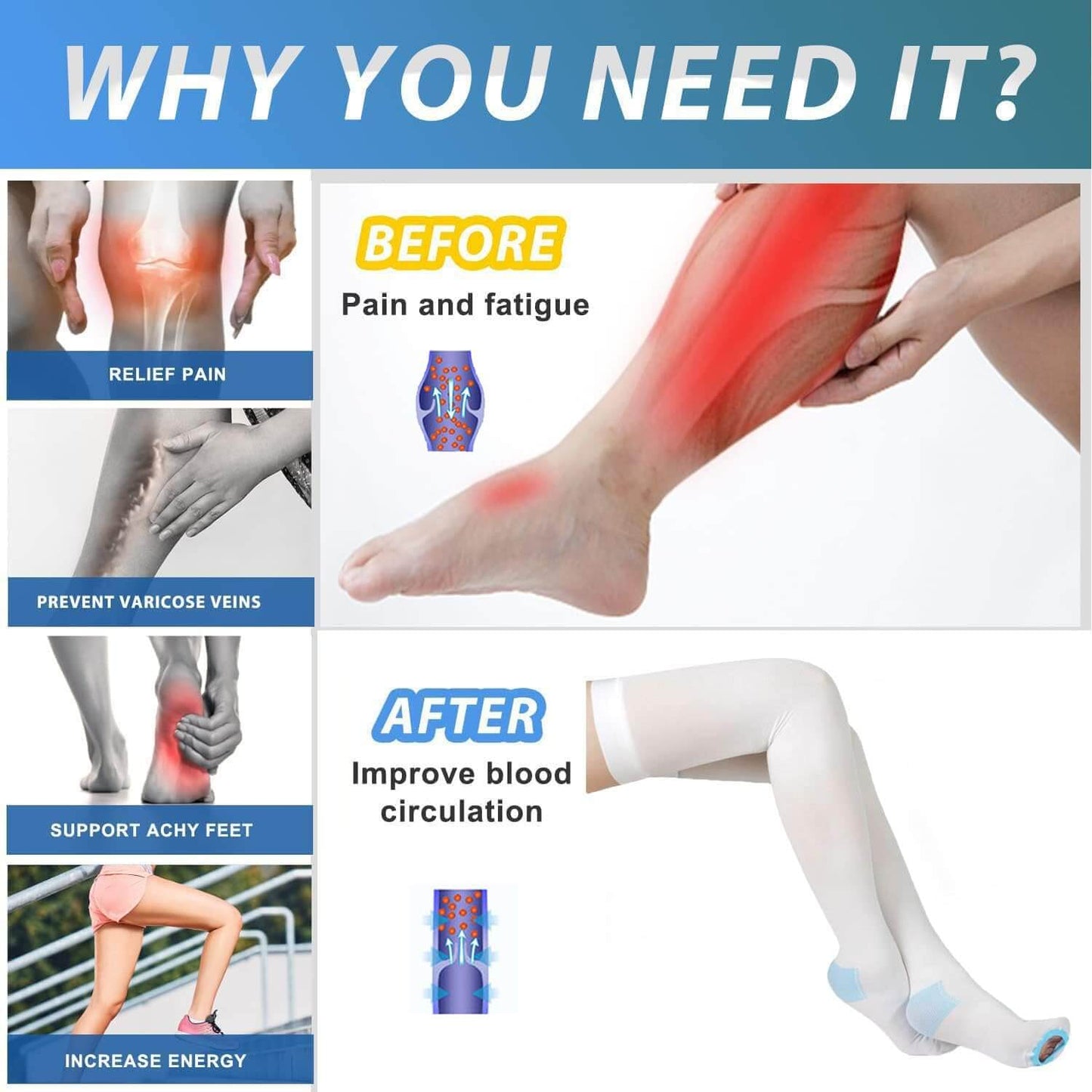 Class 1 Medical Compression Thigh-High Stockings