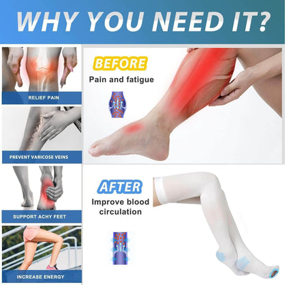 Class 1 Medical Compression Thigh-High Stockings